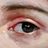nomu